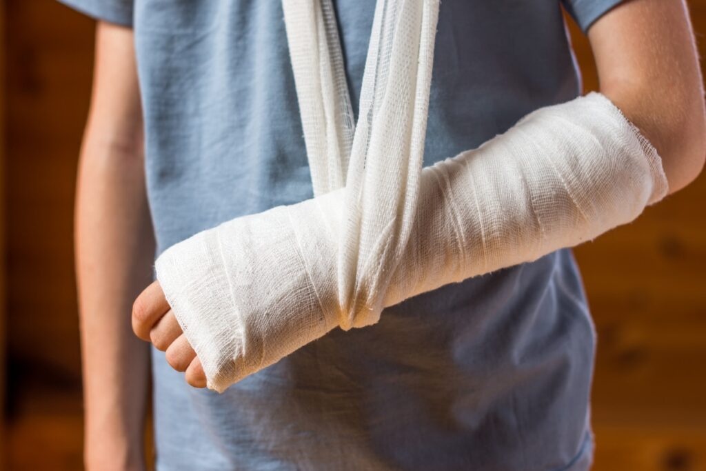 personal injury case in Denver Boy with an arm in plaster